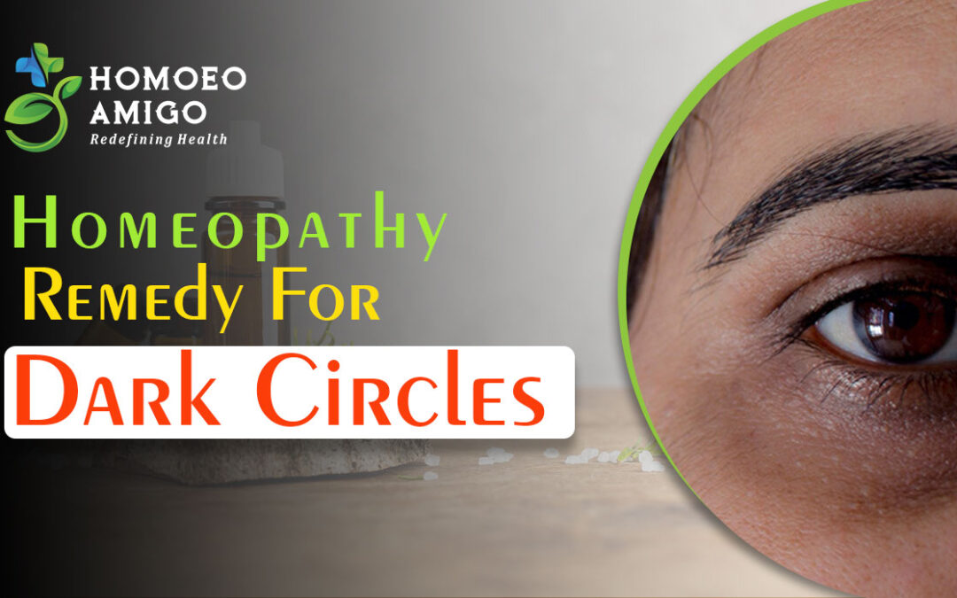 Homeopathic Remedy For Dark Circles to Enhance Your Glow