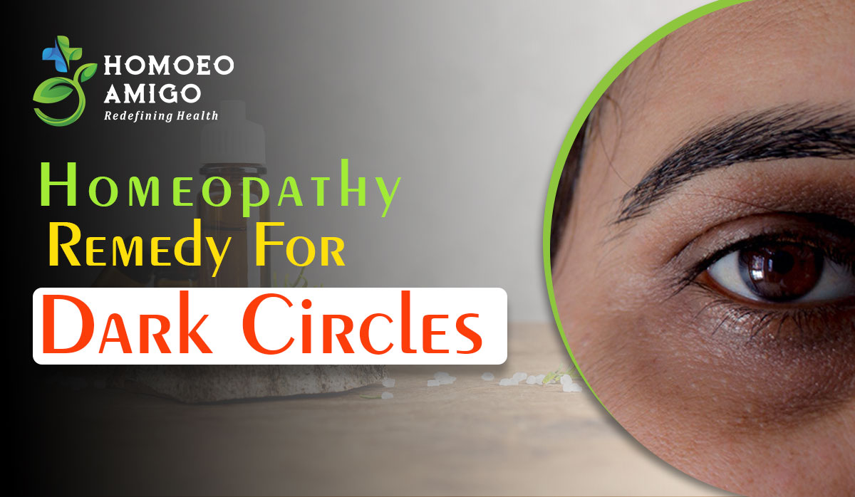 Homeopathic Remedy For Dark Circles - Homoeo Amigo