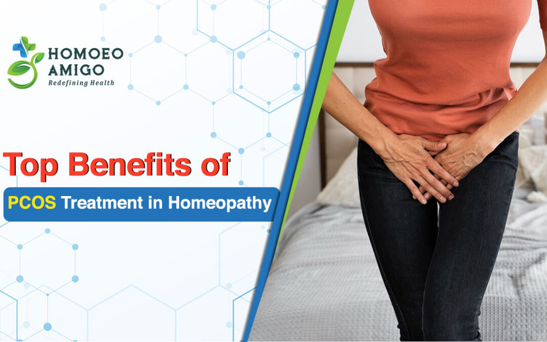 Top Benefits of PCOS Treatment in Homeopathy