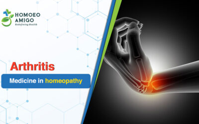 Exploring Holistic Wellness with Arthritis Medicine in Homeopathy