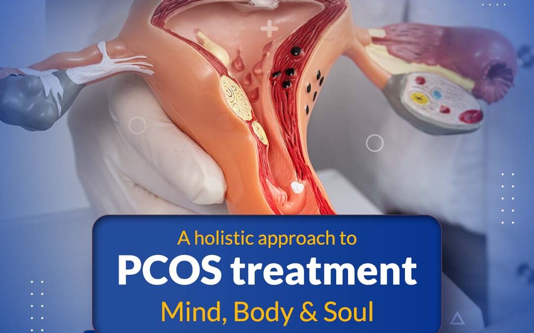 Holistic Approach to PCOS Treatment: Mind, Body & Soul