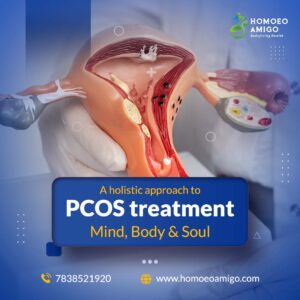 Holistic Approach to PCOS Treatment: Mind, Body & Soul