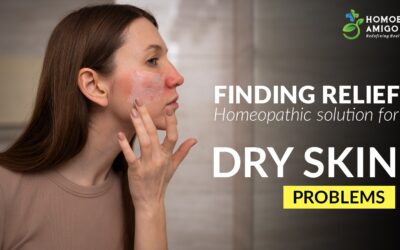 Finding relief : Homeopathic solution for dry skin problems