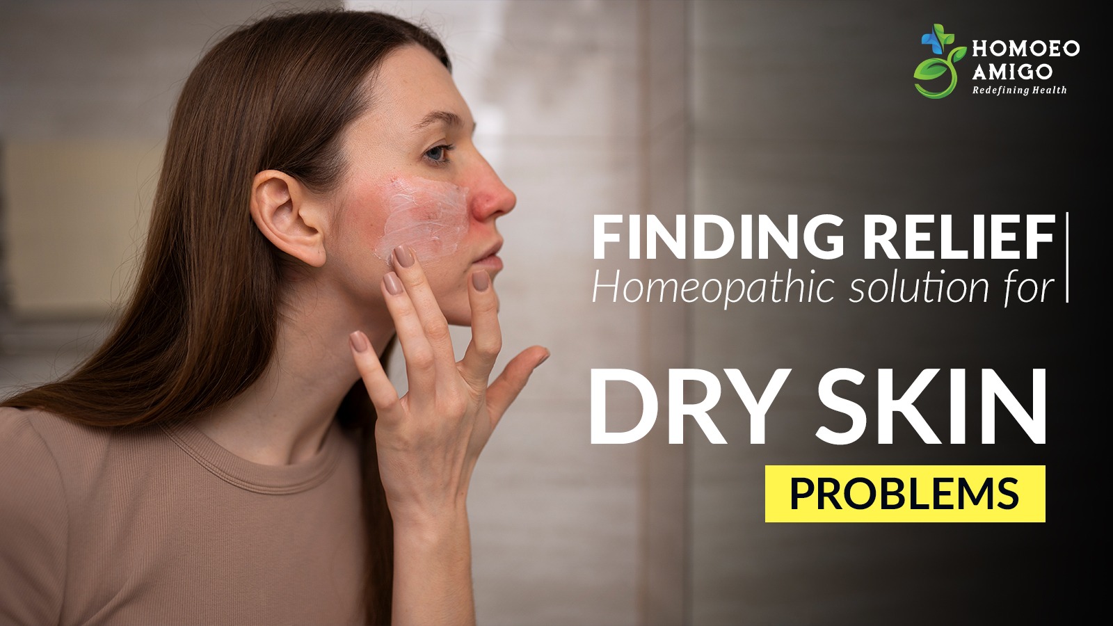 homeopathic treatment for dry skin